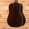 Gallagher Bluegrass Bell Rosewood - Sunburst