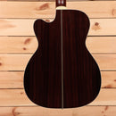 Santa Cruz OM Custom acoustic guitar Buttered Toast Sunburst with rosewood back and sides